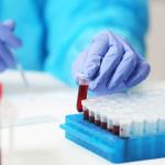 PATIKIL Centrifuge Tube Storage Box Set - 2 Pcs