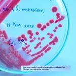 Transparent Petri Dishes with Lid - 30 Pack