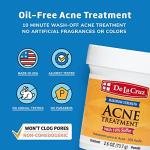 De La Cruz 10% Sulfur Ointment for Acne