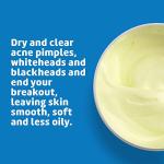 De La Cruz 10% Sulfur Ointment for Acne