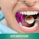 Dental Bite Blocks - Silicone Mouth Props Set