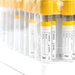 10ml Gel Clot Blood Collection Tubes - 100 Pcs