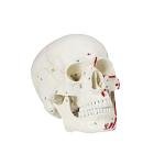 Vision Scientific VAL208 Marked Human Skull Model