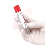 10 mL Premium Glass PRF Tubes, Box of 10