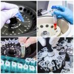 BKSIGA 1.5ml Microcentrifuge Tubes with Snap Caps