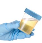 Leak-Proof Specimen Cups with Screw-On Lids - 25 Pack