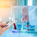 Adjustable Iron Test Tube Clamp for Labs