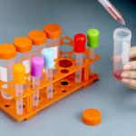 QWORK Jumbo Test Tubes and Liquid Droppers Set