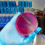 20 Pack Disposable Plastic Inoculation Loops for Labs