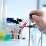 Borosilicate Glass Test Tubes with Screw Caps (10 Pack)