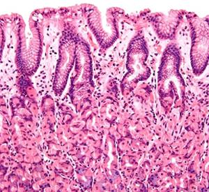 100 Microscope Prepared Histology Slides Set
