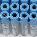 Vinmax 100PCS 2ml Clear Lab Tubes