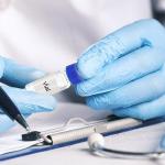 PATIKIL 2ml HPLC Autosampler Vials with Septa, 100 Pack