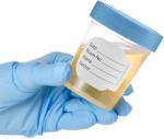 Leak-Proof Specimen Cups - 4oz Urine Jars (10)