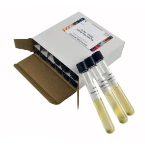 Aldon Tryptic Soy Broth Tubes, Pack of 12