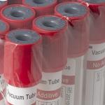 Veterinary Lab Vacuum Collection Tubes, 100pcs