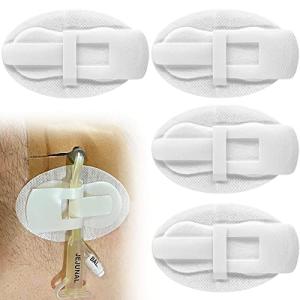 Catheter Stabilization Device for Feeding Tubes (5 Pack)