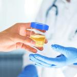 50PCS Urine Specimen Collection Cups with Lids