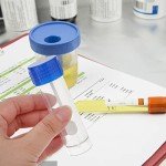 10 Pack Specimen Cups for Lab Use - 25ml-30ml