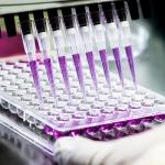 PATIKIL 10ul Autoclavable Pipette Tips, 100-Pack