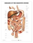 Digestive System Diseases Anatomical Chart
