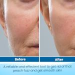 Sterile Disposable Scalpels - Box of 10