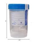 Sterile Specimen Cups with Screw-On Caps - 12 Pack