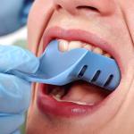 Annhua Autoclavable Dental Impression Trays Set, 10 PCS