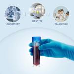 ULTECHNOVO 10-Pack Specimen Cups with Lids