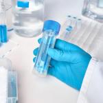 ULTECHNOVO 10-Pack Specimen Cups with Lids