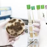 Reusable Metal Inoculating Loop Set with Nichrome Tips