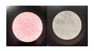 Human Blood Smears with HE & Wright's Stains