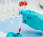 CryoClear 5mL Barcoded Cryogenic Vials – Case of 50