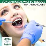 5-Piece Stainless Steel Precision Probe Set