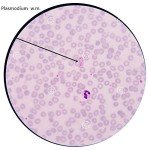 Pack of 5 Prepared Protozoa Microscope Slides