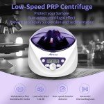 Maccx PRP Benchtop Centrifuge, 300-5000 RPM