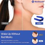 Full Tube Frame Strap Kit for Airfit N20