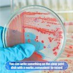 Kigley 1000 Pcs Sterile Plastic Petri Dishes