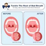 Tonsil Stone Remover Vacuum with Oral Accessories