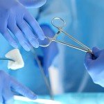 12" Rochester Pean Hemostat Forceps - Set of 2