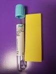 Citrate Blue Top Tubes - 4.5 ml Pack