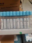 Citrate Blue Top Tubes - 4.5 ml Pack
