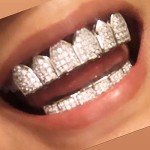 18K Gold Plated Iced-Out Grillz with Molding Bars