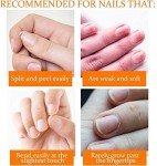 Nail Tek Nail Repair Kit for Damaged Nails