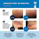 Rechargeable Electric Callus Remover and Foot File