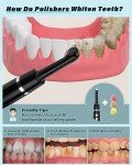 Rechargeable Tooth Polisher & Whitening Kit