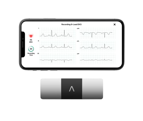 KardiaMobile Six-Lead EKG Monitor for Home Use