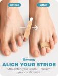 Hammer Toe Straightener Wraps - 4 Pack