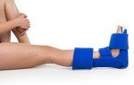 Procare ProWedge Night Splint for Plantar Fasciitis