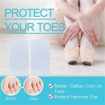 Toe Sleeves and Protectors – 10 Pack